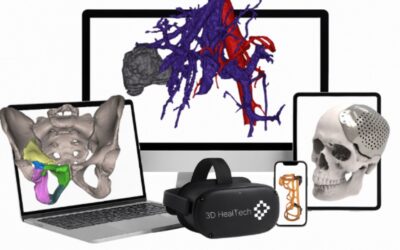 3DHealTech: Нова генерација персонализоване ортопедије